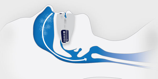 How Do Anti Snoring Mouthpieces Work?